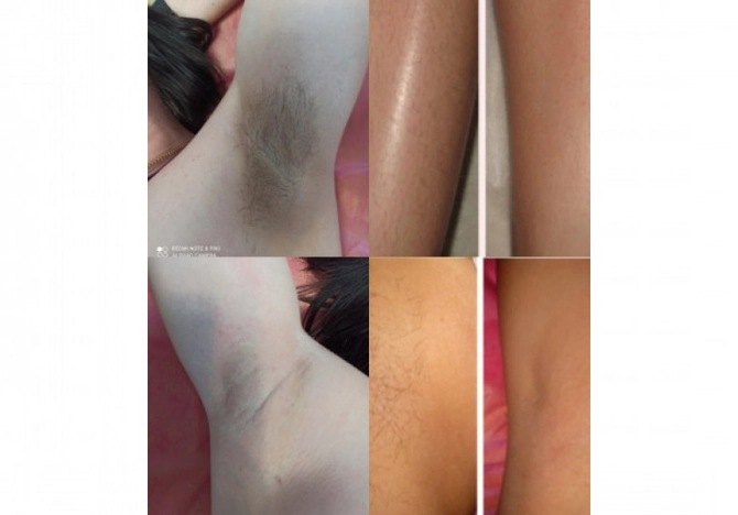 Фото