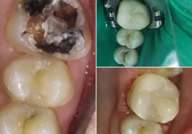 Фото
