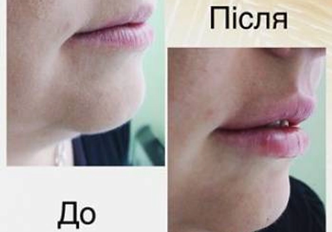 Фото