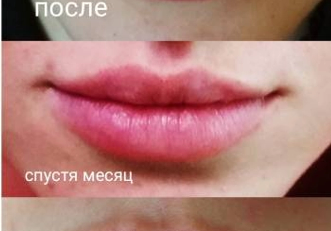 Фото