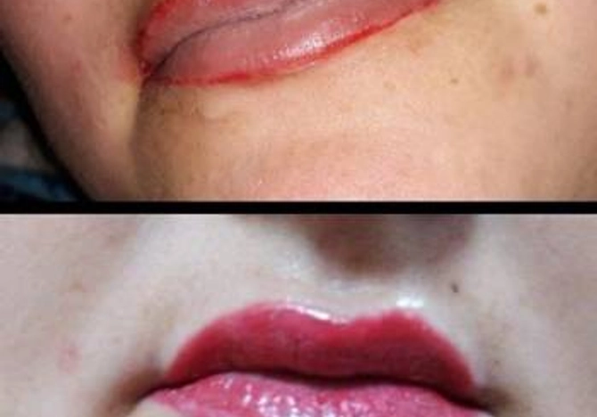 Фото