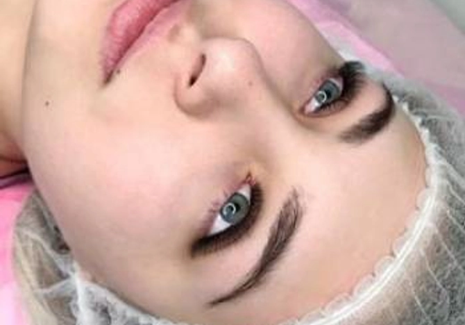 Фото
