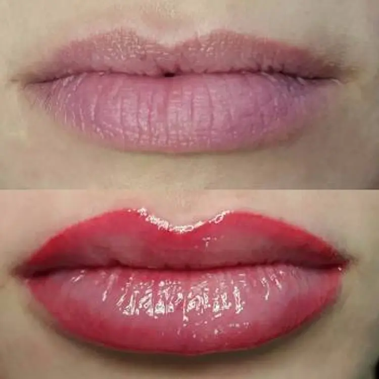 Фото