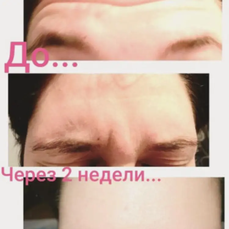 Фото