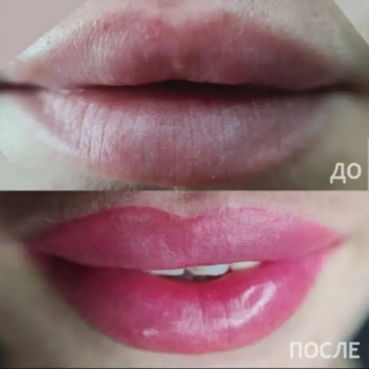 Фото