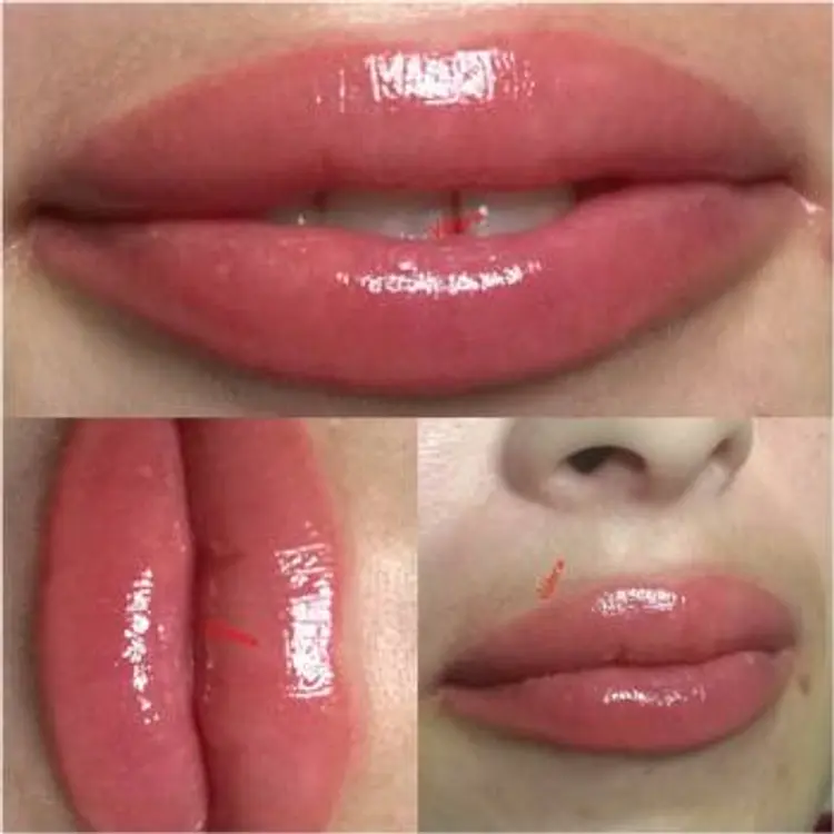 Фото