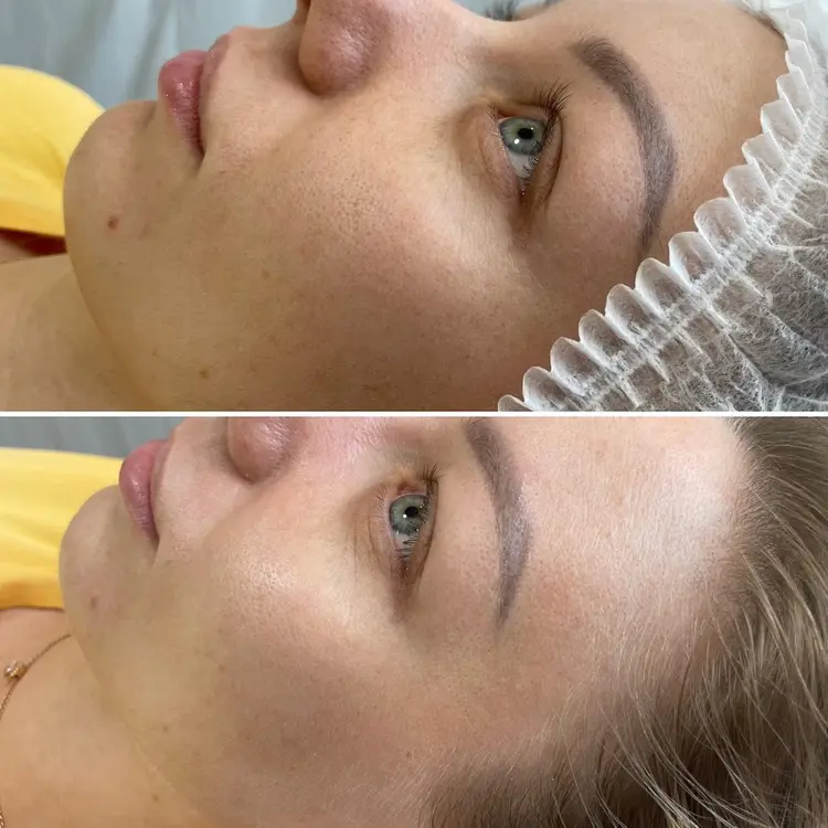 Фото