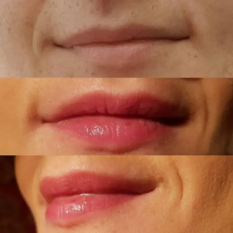 Фото