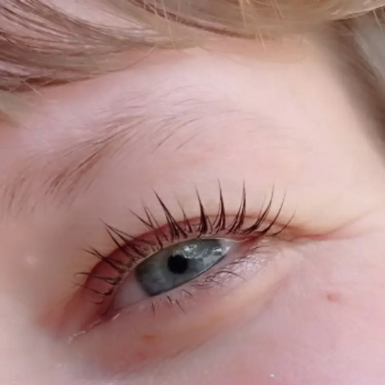 Фото