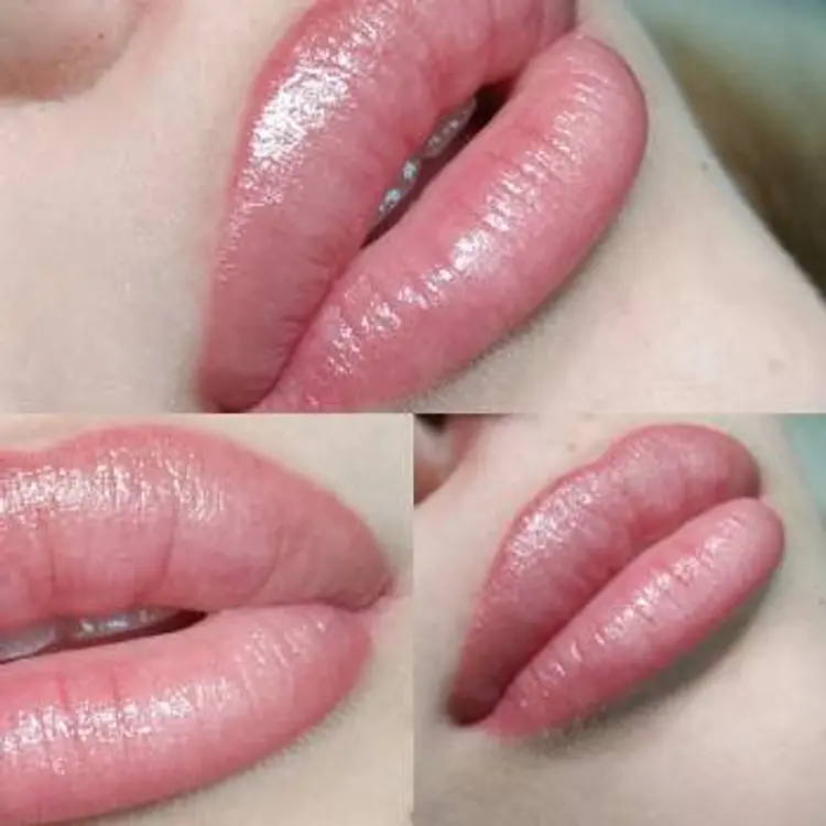 Фото