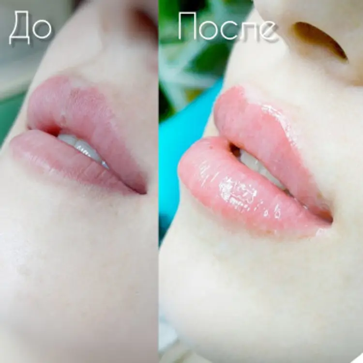 Фото