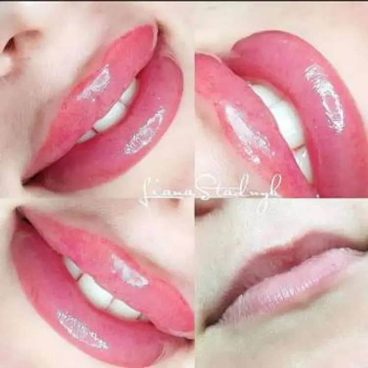 Фото