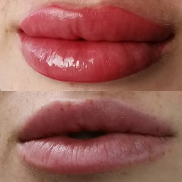 Фото