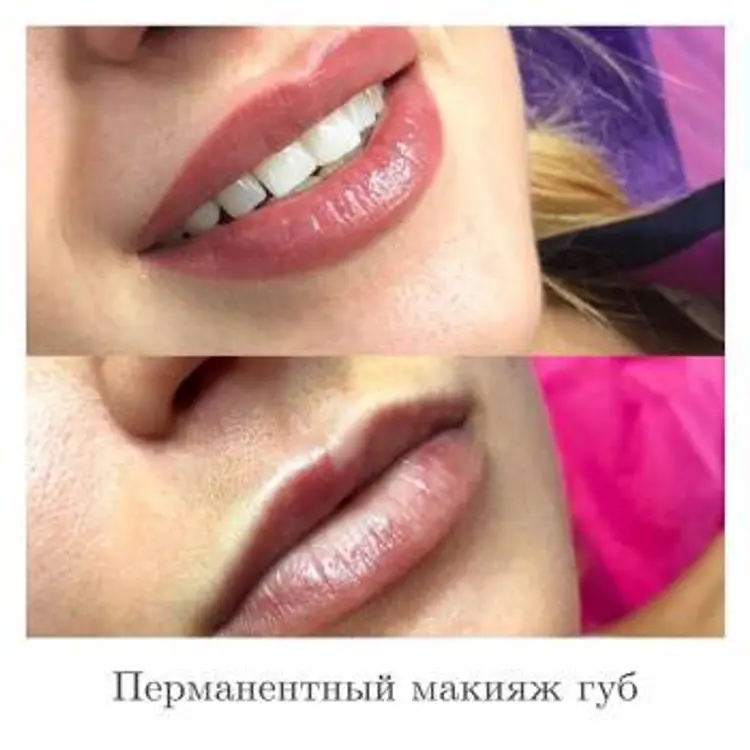 Фото