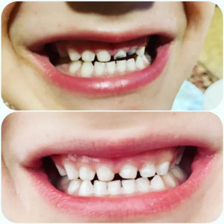 Фото